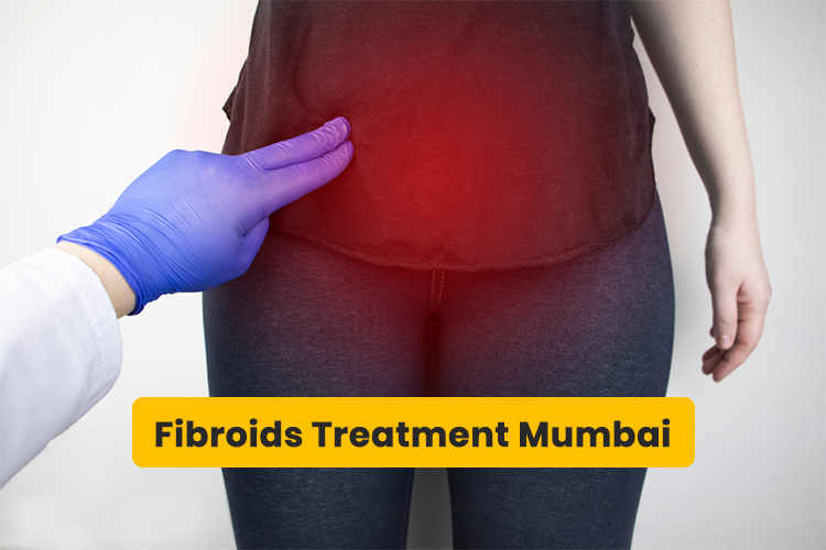 Fibroids Treatment Mumbai Dr Sandhya Shah
